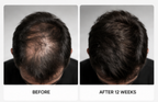 Alphavance — Customer comparison after twelve weeks — English