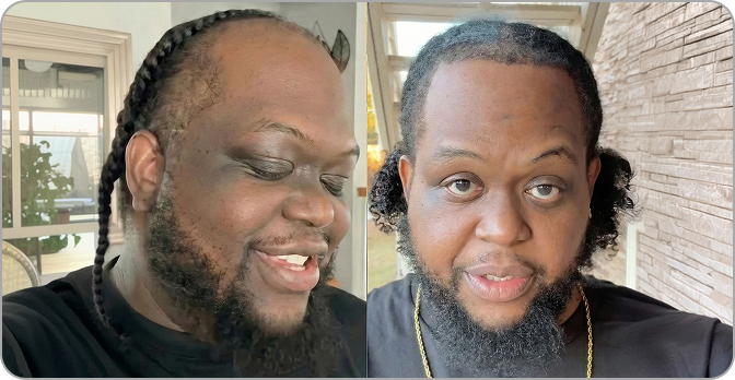 Before and after photo of AlphaVance customer confidence transformation