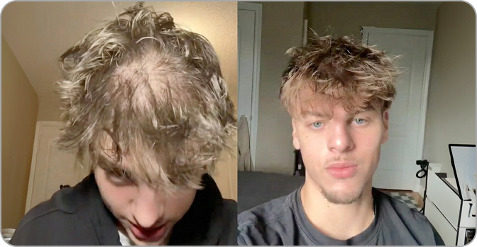 AlphaVance customer result